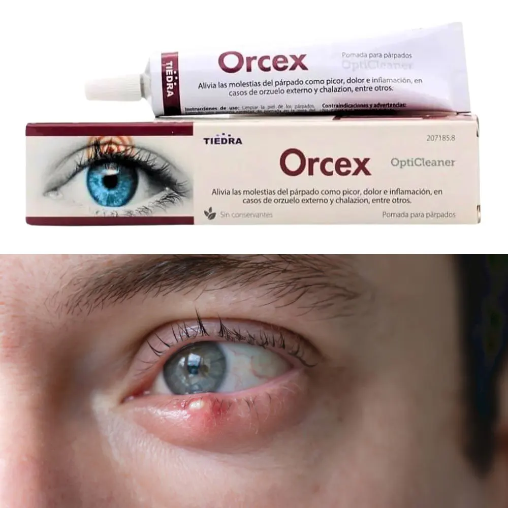 Orcex Crema Orzuelo 15 g | Alivio Inflamación Párpado